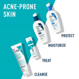 Cerave Acne Foaming Cream Cleanser